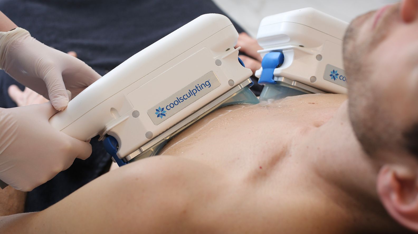 CoolSculpting