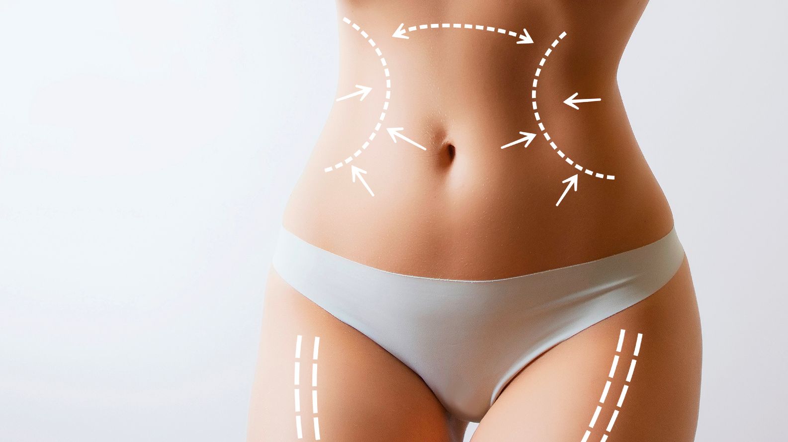 Liposuction