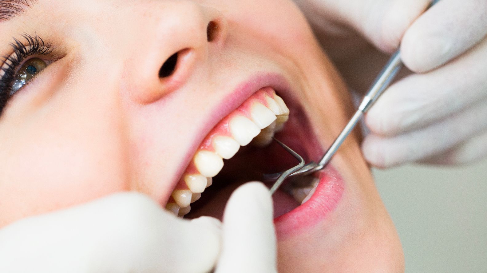 Diş Dolgusu ve Kanal Tedavisi