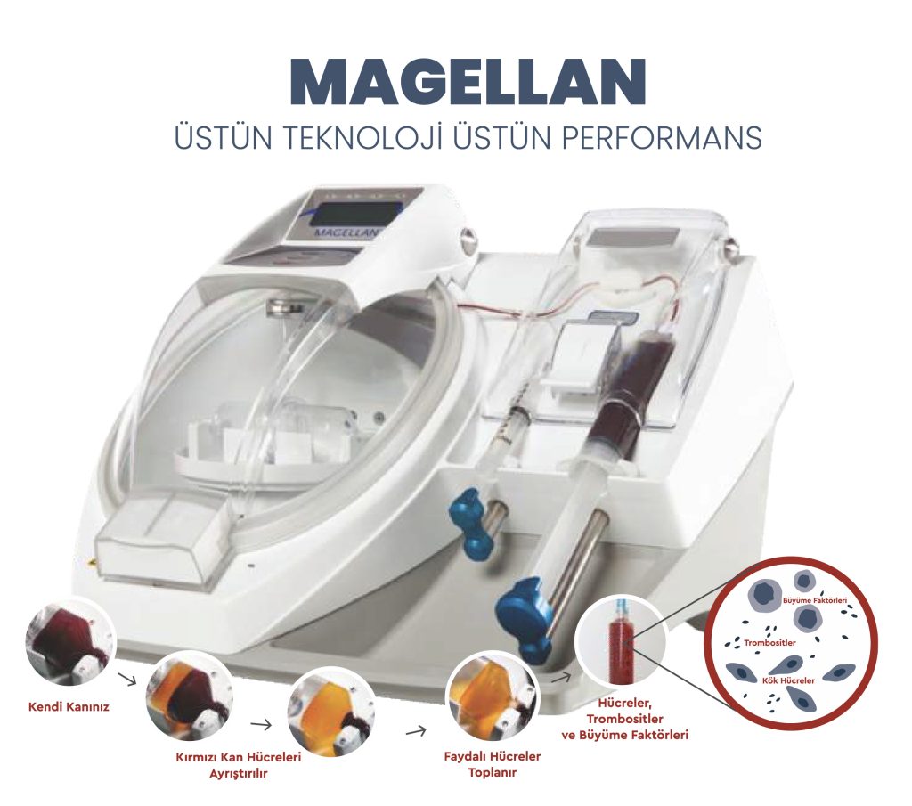 MAGELLAN INFO 02