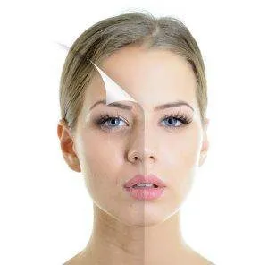 Cildin İçin En Uygun Tedaviyi Keşfet!