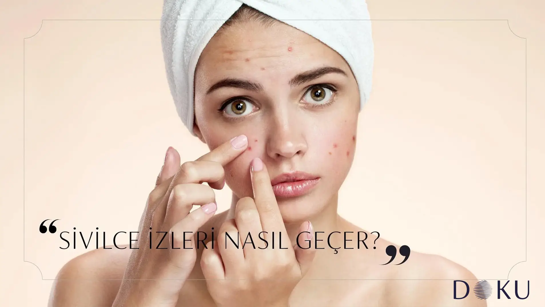 Sivilce İzleri Nasıl Geçer?