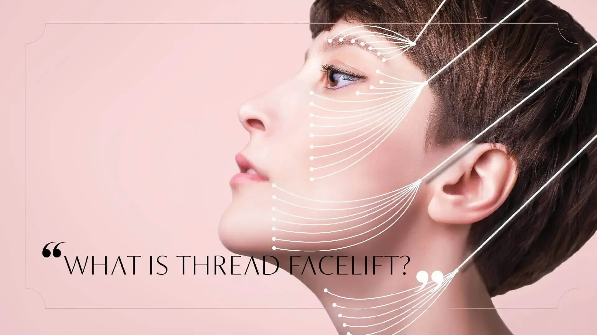 What is a Thread Facelift?