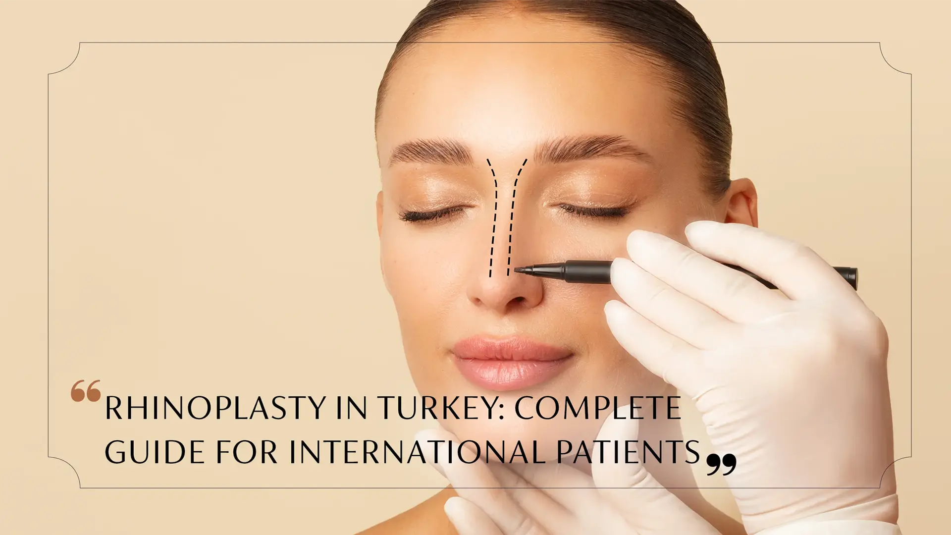 Rhinoplasty in Turkey: Complete Guide for International Patients