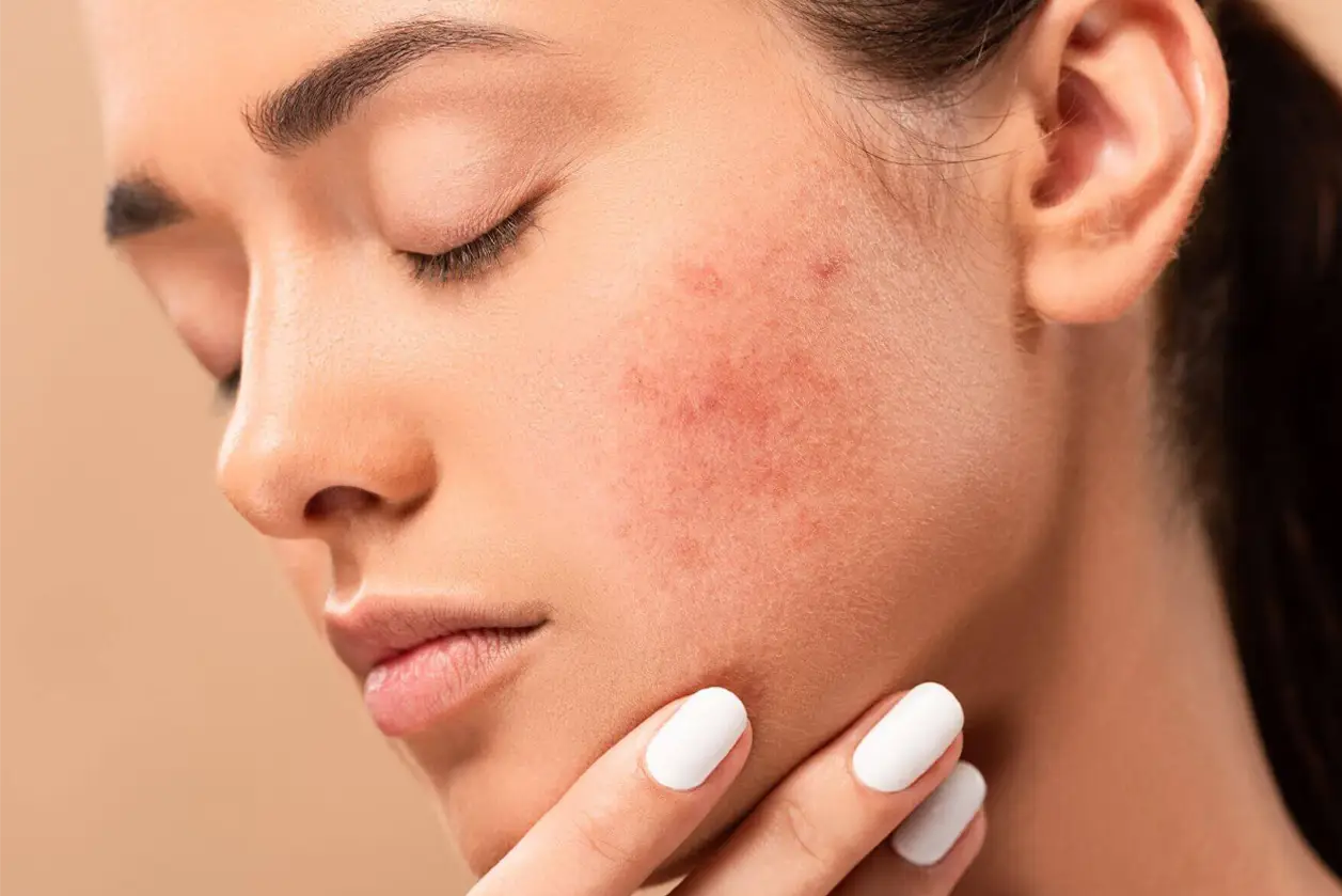 How to notice the spots on the skin? How to notice the spots on the skin?