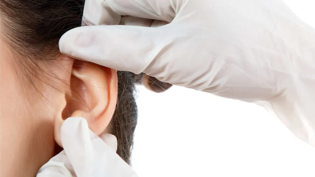 Kulak Estetiği Sonrası Dikkat Edilmesi Gerekenler Kulak Estetiği Sonrası Dikkat Edilmesi Gerekenler