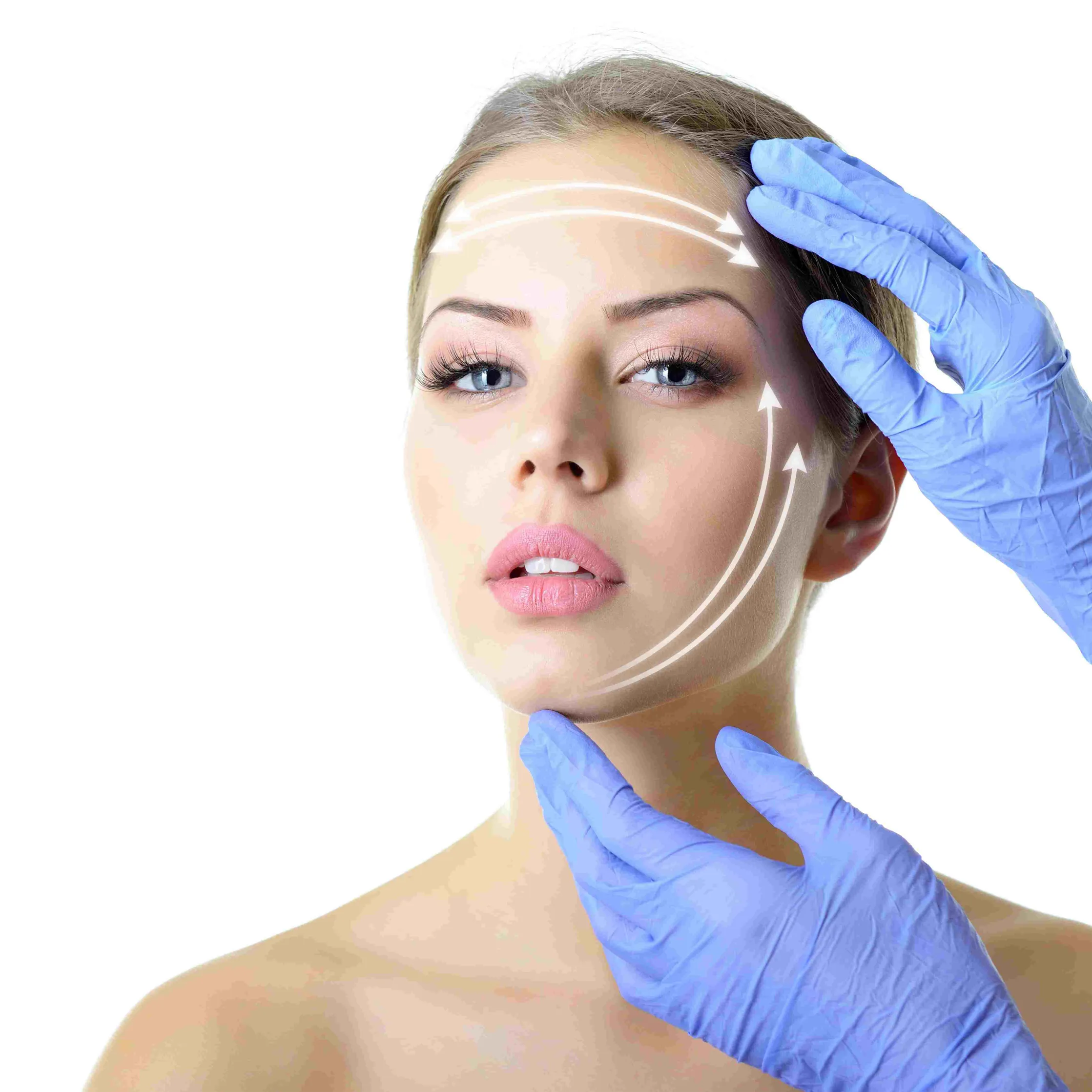 What is a Thread Facelift?