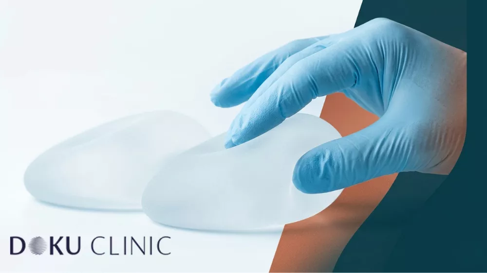 Breast Augmentation with Teardrop Implants: Results with Motiva & Mentor at Doku Clinic