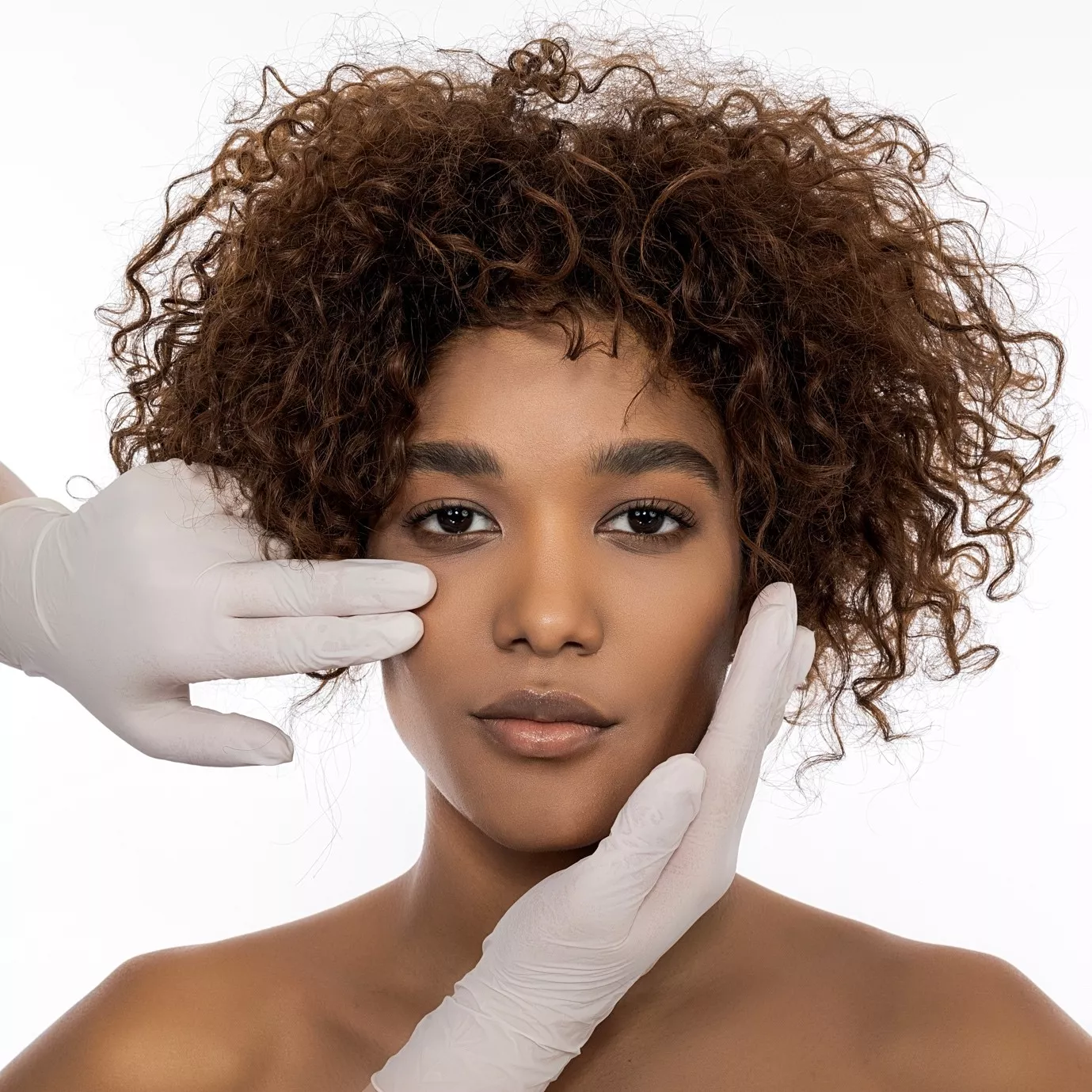 Deep Plane Facelift Before and After