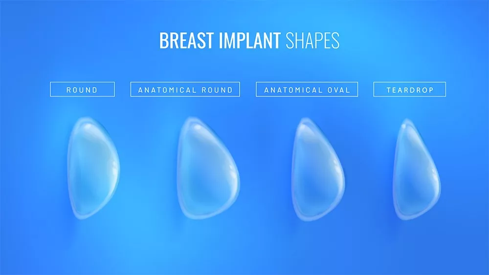 Breast Augmentation with Teardrop Implants: Results with Motiva & Mentor at Doku Clinic