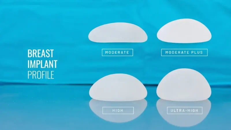 Arten von Brustimplantaten: die passende Größe, Form und Füllung finden A visual guide to breast implant sizes and profiles, displaying four white implants labeled moderate, moderate plus, high, and ultra-high against a blue background.