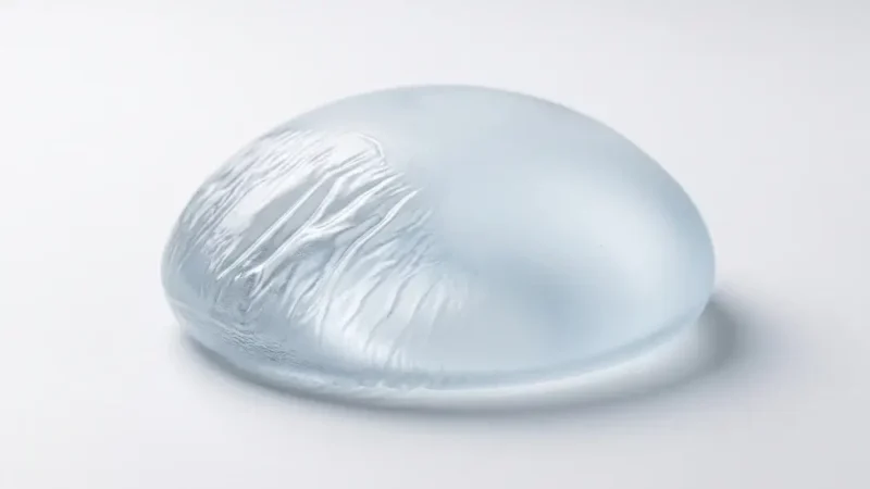 Breast Implant Rippling: Why It Happens, How to Avoid it & How to Fix It A close-up illustration of a clear, translucent breast implant resting on a white background. The left side of the implant features prominent wrinkles and folds, demonstrating implant rippling, while the right side remains smooth.