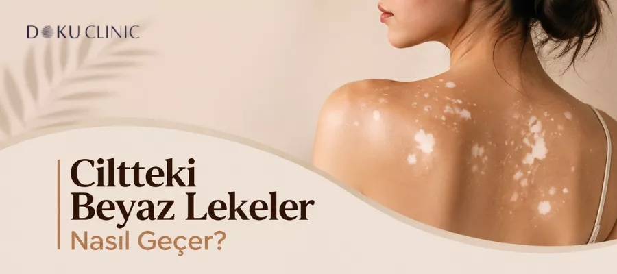 Ciltteki Beyaz Lekeler Nasıl Geçer?